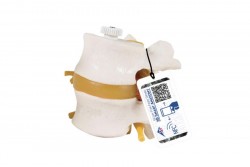 Model 2 ludzkich kręgów lędźwiowych z wypadniętym dyskiem, elastycznie zamontowane - 3B Smart Anatomy - 1000152 [A76/9]